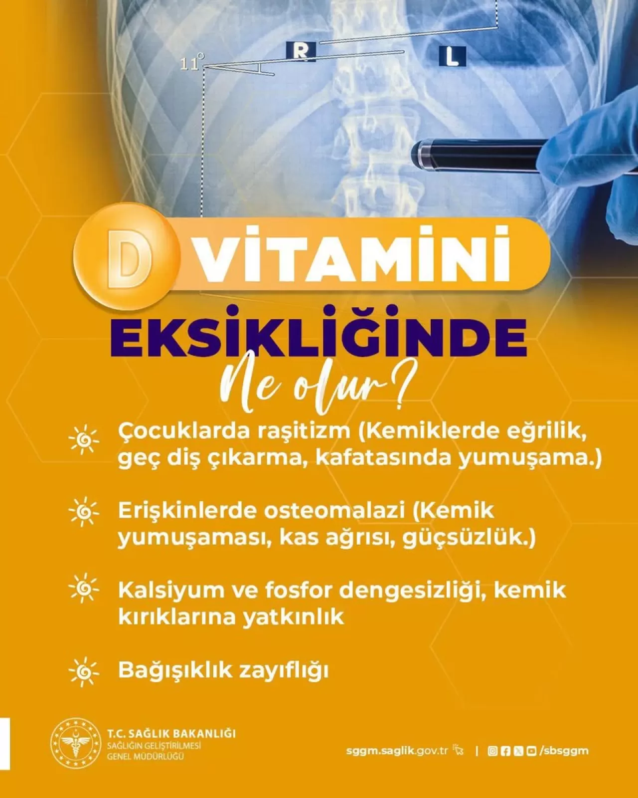 D Vitamini Eksikliğini Önlemenin Doğal Yolu: Güneş Işığı