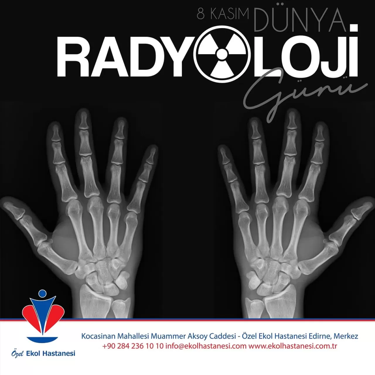 Edirne Özel Ekol Hastanesi'nden Dünya Radyoloji Günü Mesajı: Erken Tanıda Kritik Rol