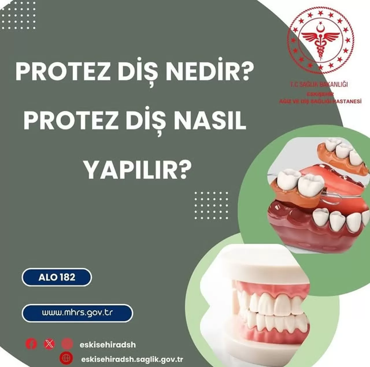 Eskişehir'de Protez Diş Tedavisinde Estetik ve İşlevsellik Ön Planda