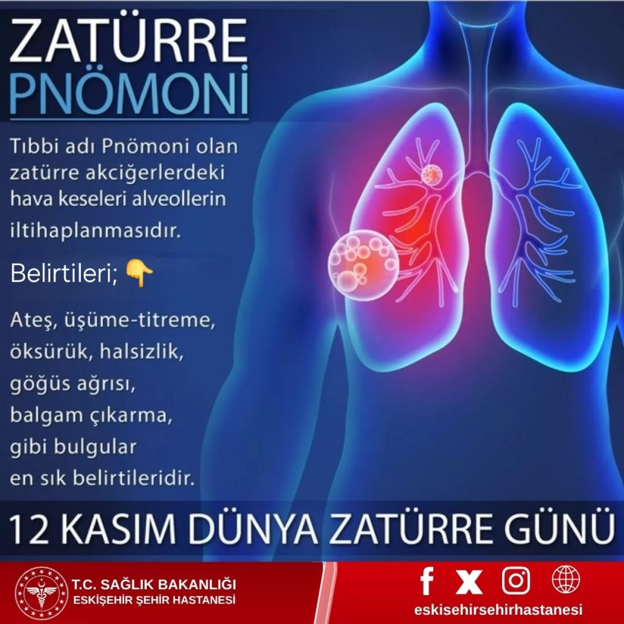 Eskişehir Şehir Hastanesi'nden Zatürre Uyarısı: Belirtileri Ciddiye Alın