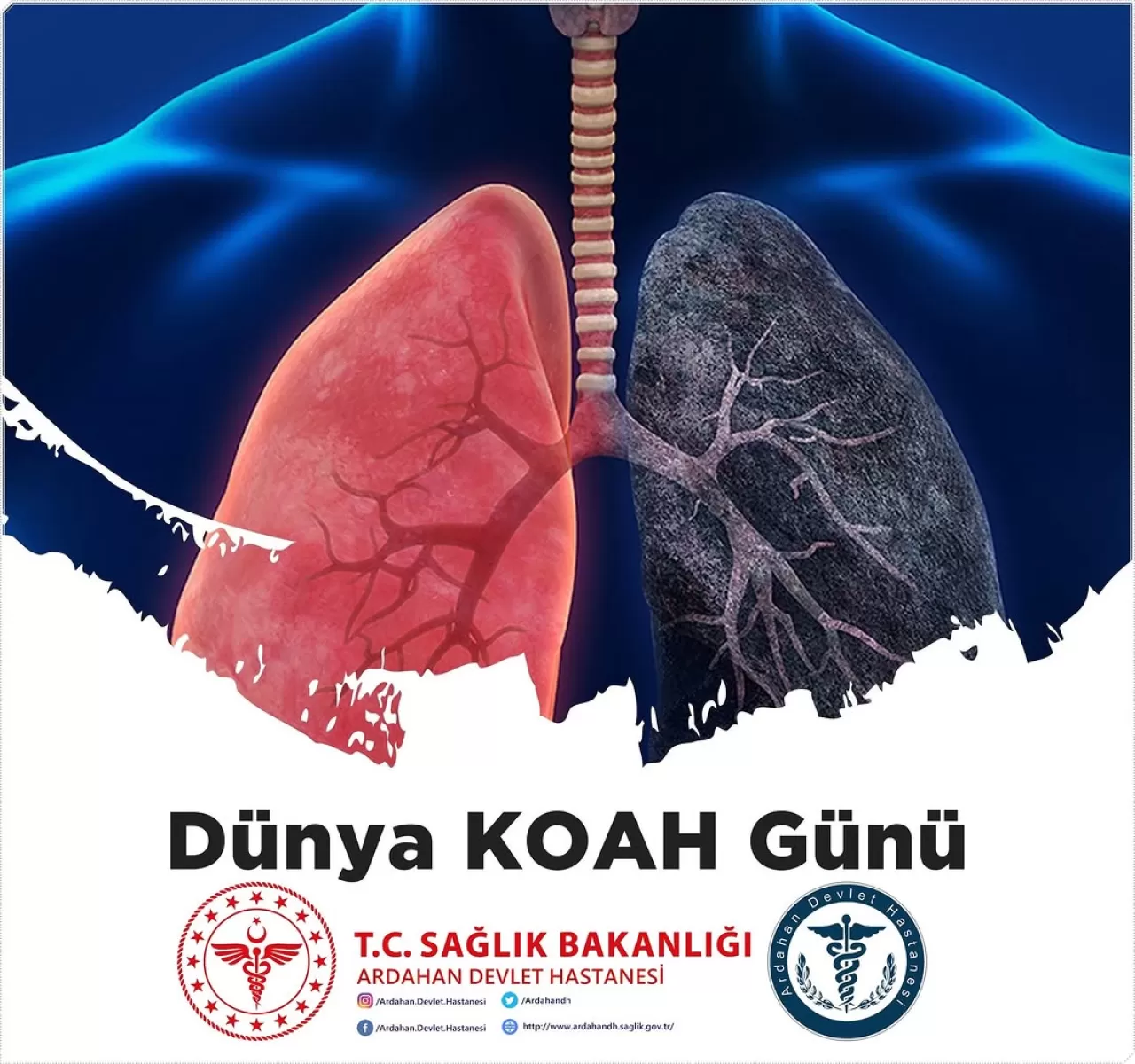 Ardahan Devlet Hastanesi, KOAH Farkındalığı İçin Harekete Geçti