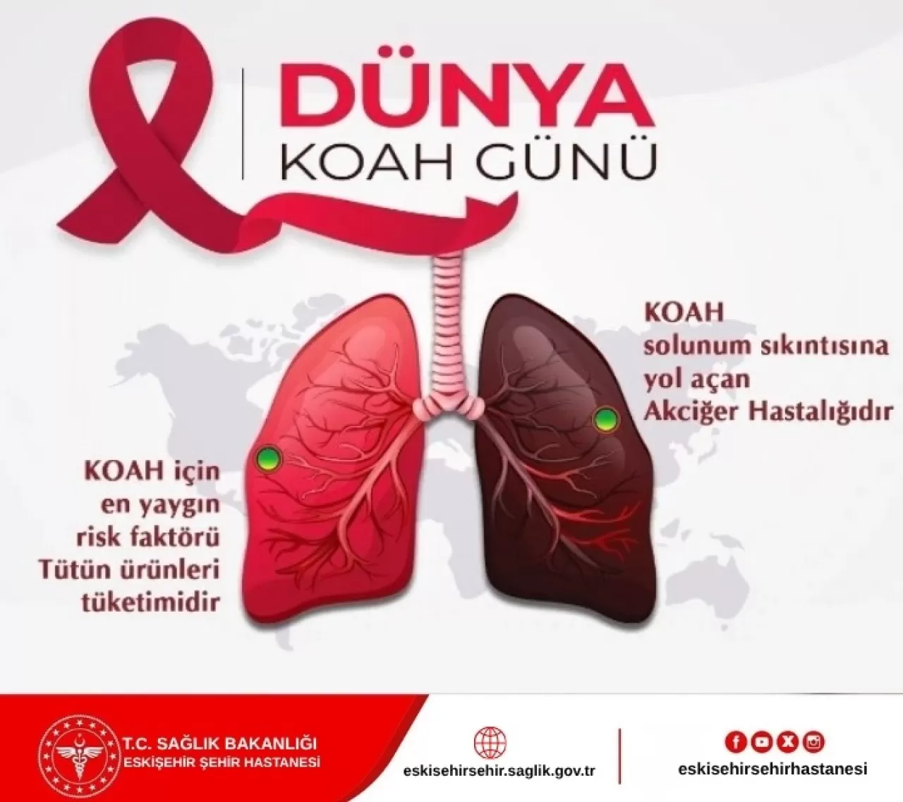 Eskişehir'de KOAH Farkındalığı: Önlenebilir ve Tedavi Edilebilir Bir Hastalık