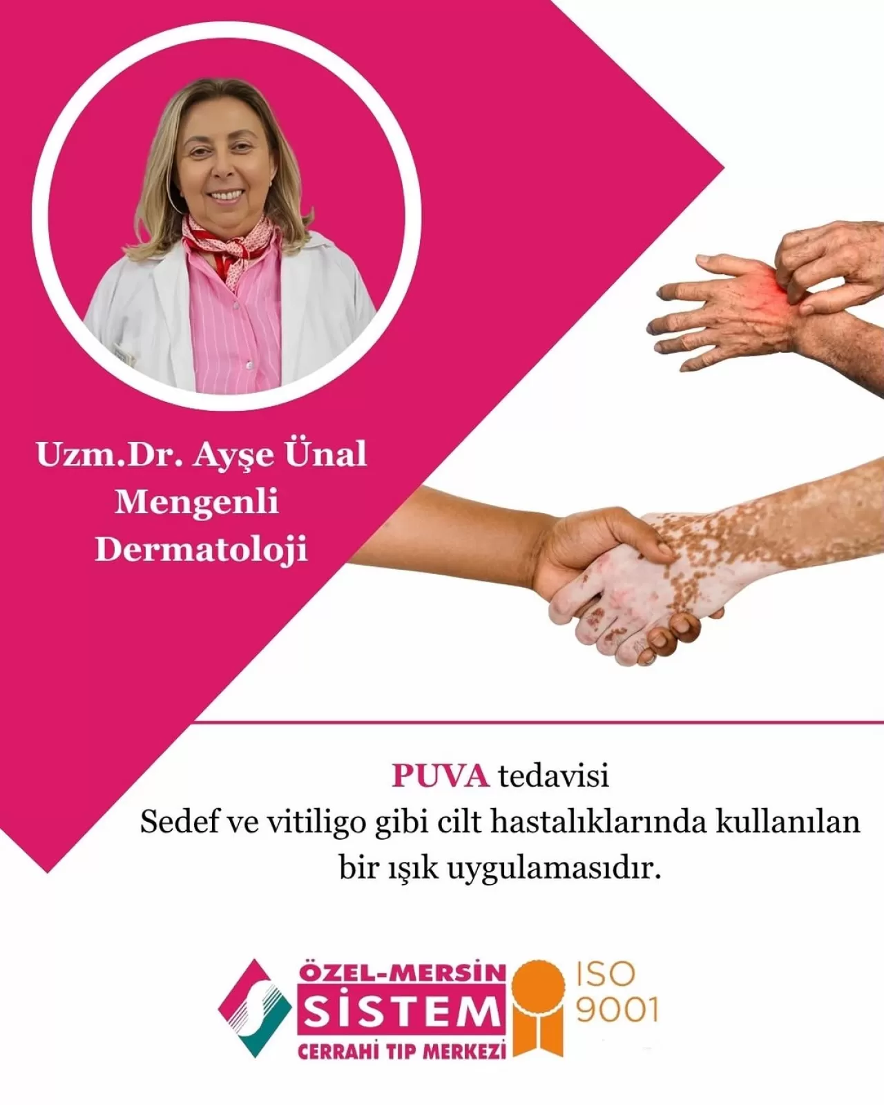 Mersin'de Cilt Hastalıklarına Çözüm: PUVA ve UVB Fototerapi Tedavisi