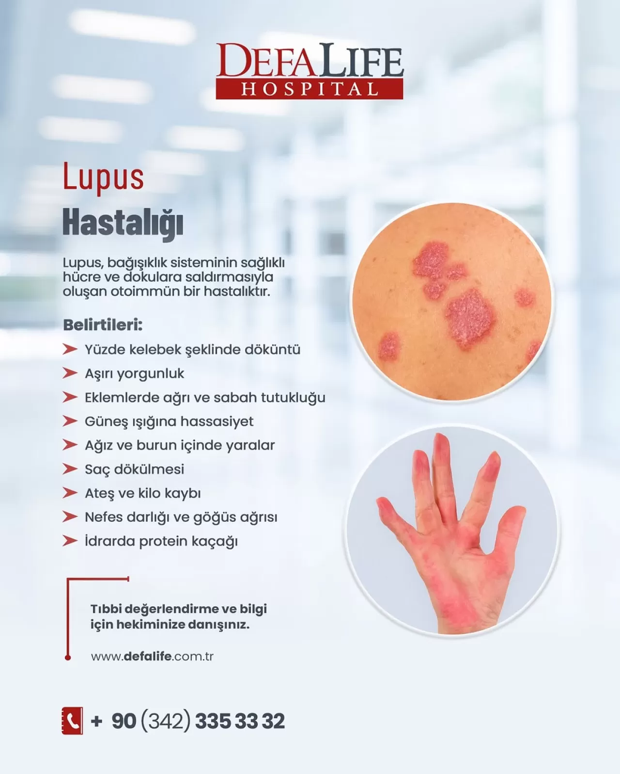 Gaziantep Defa Life Hastanesi, Lupus Hastalığı Konusunda Bilgilendirme Yaptı