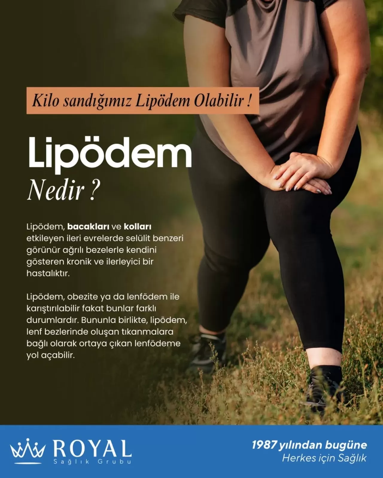 Lipödem Hastalığı: Belirtileri ve Lenfödem ile Farkları
