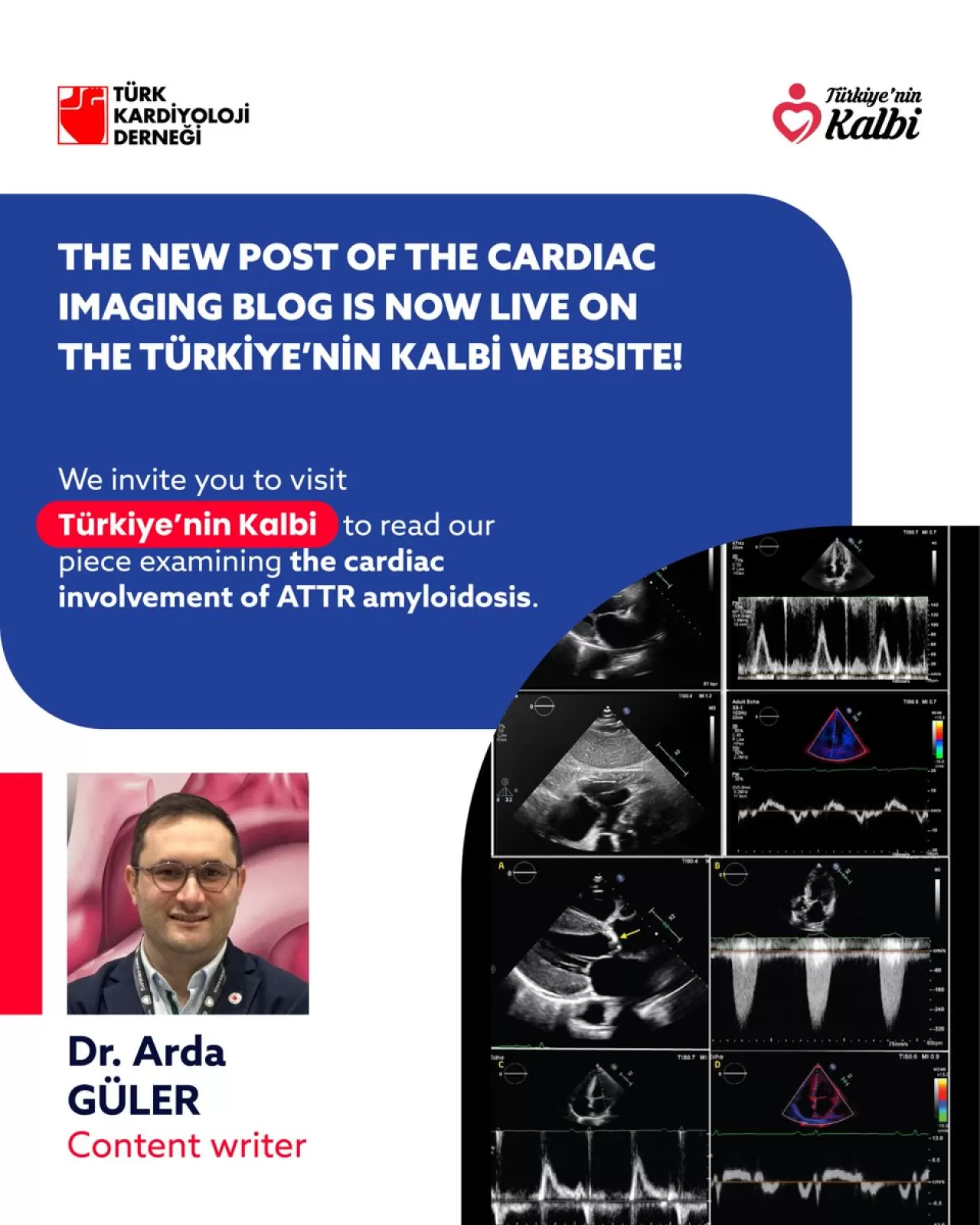 ATTR Amiloidozunda Kalp Tutulumu: Türk Kardiyoloji Derneği Uzmanlara Yönelik Kaynak Paylaştı