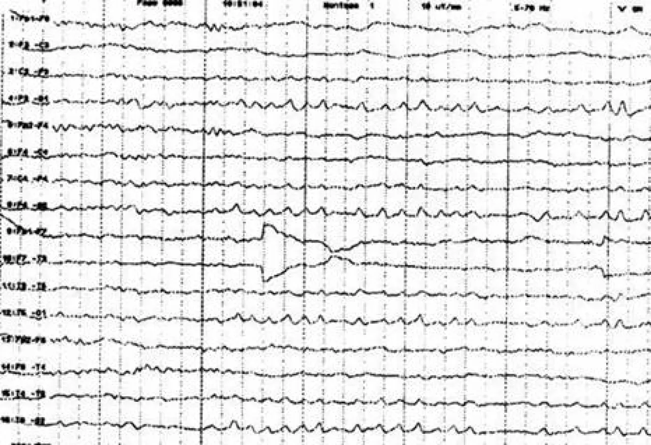 İçsel Saatinizin Gizli Gücü: Günlük Uyum Dalgalarınızı Keşfedin