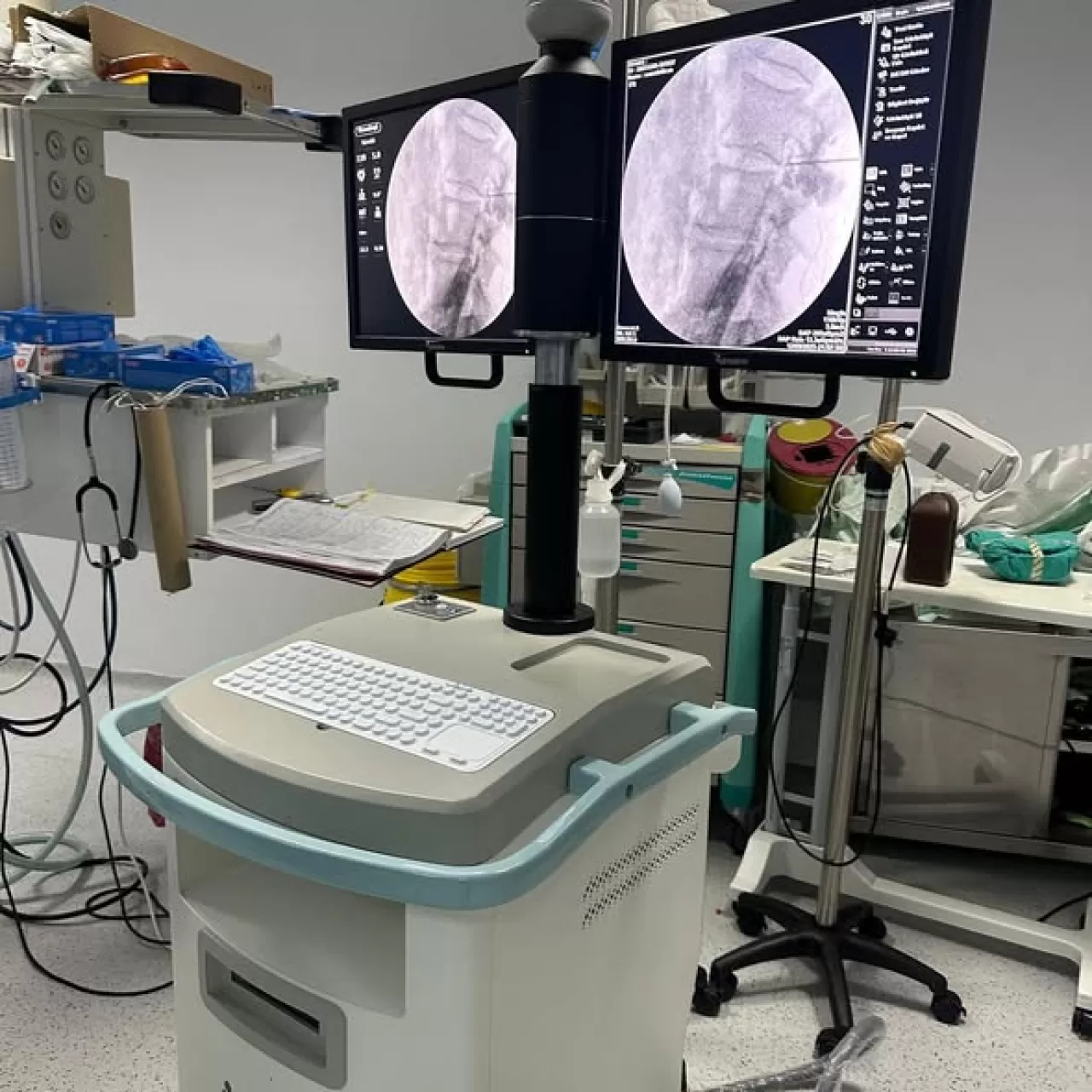 Amasya Hastanesi'ne Yeni Nesil C Kollu Skopi Cihazı Kazandırıldı