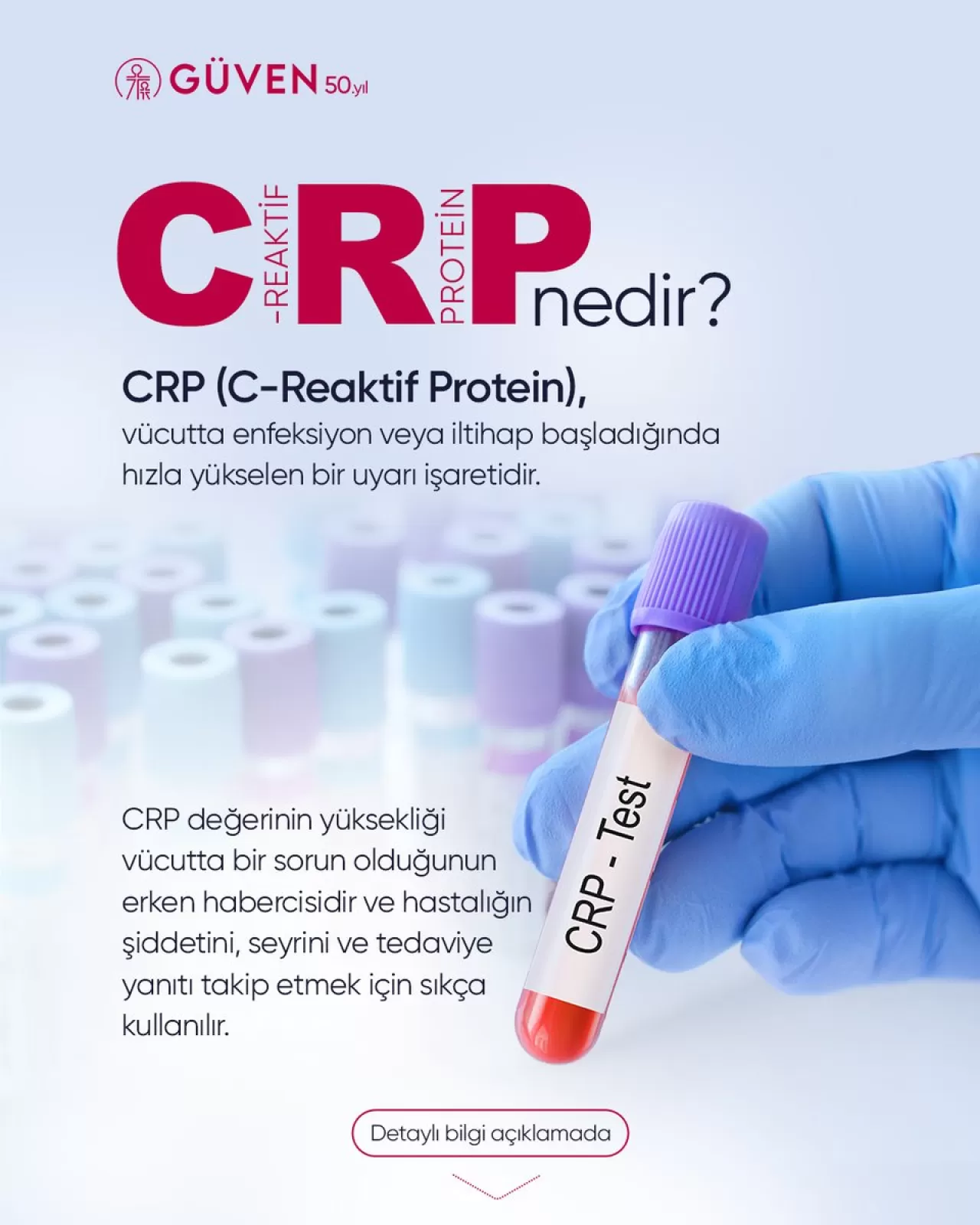 CRP Testi: Vücutta İltihabı Tespit Eden Önemli Bir Gösterge