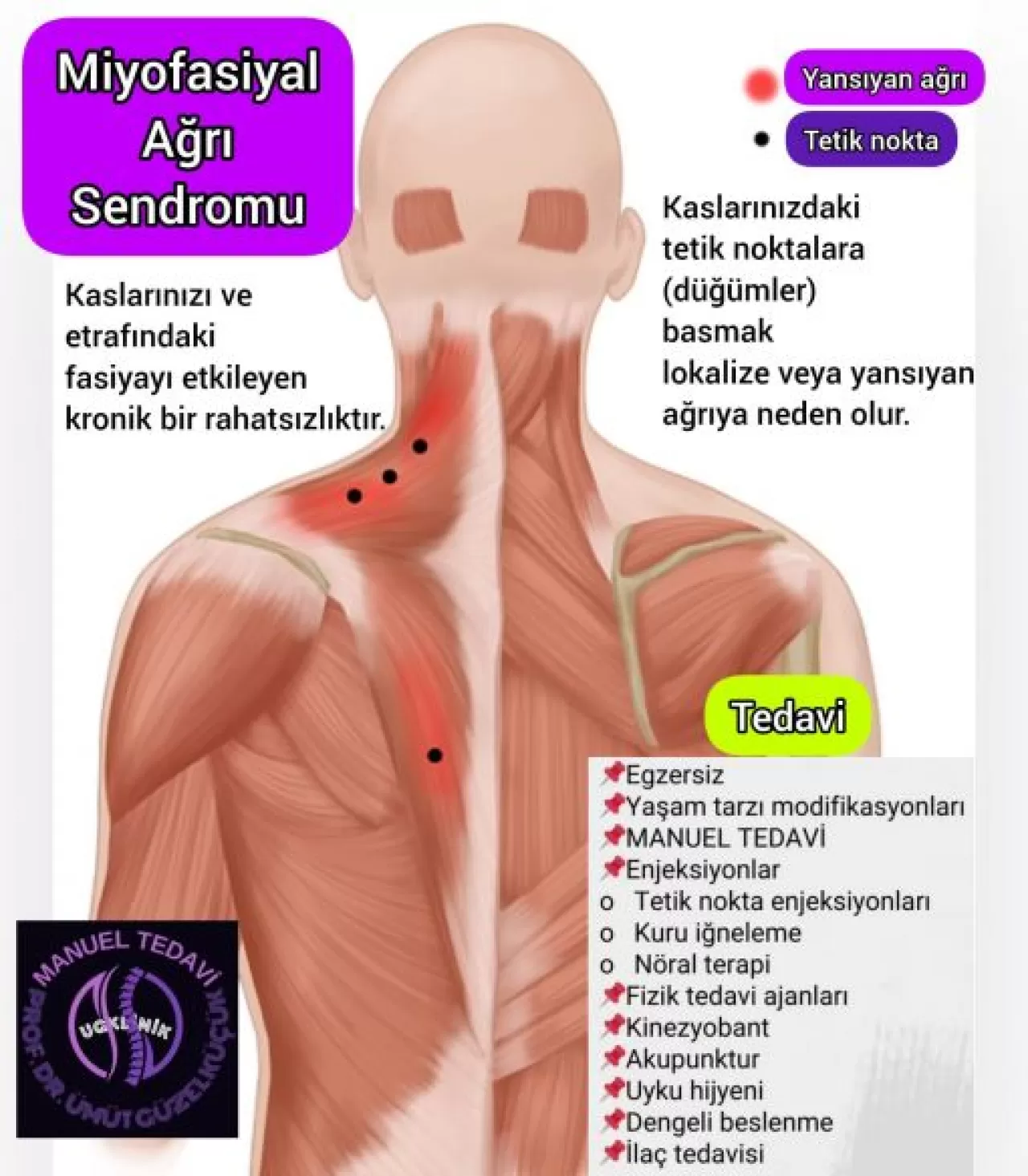 Kronik Kafa Derisi Gerginliği: Sessizce İlerleyen Bir Sağlık Sorunu