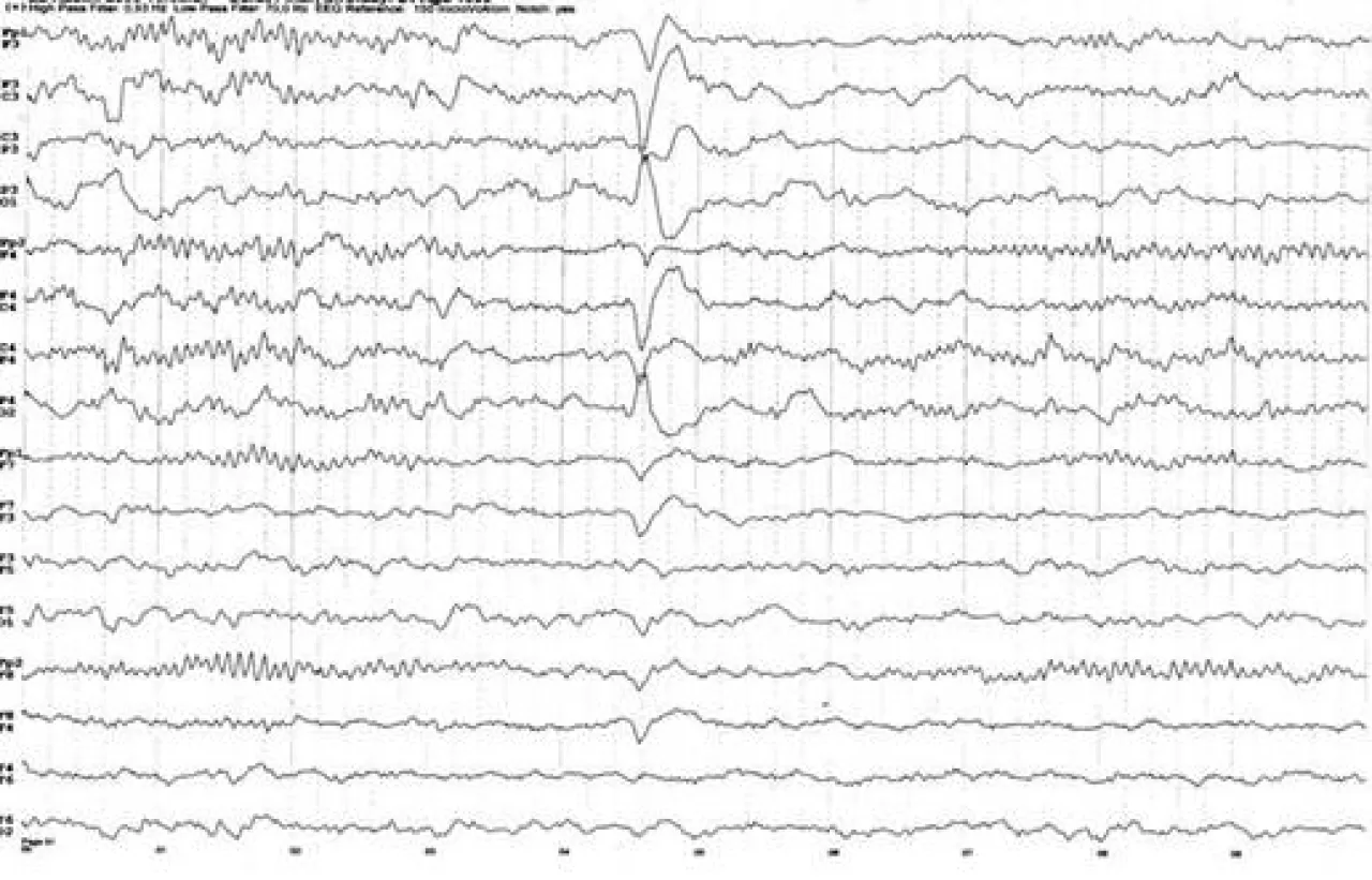 Günlük Yaşamda Psikolojik Denge: Yumuşak Geçişler ve İçsel Ritimlerin Gücü
