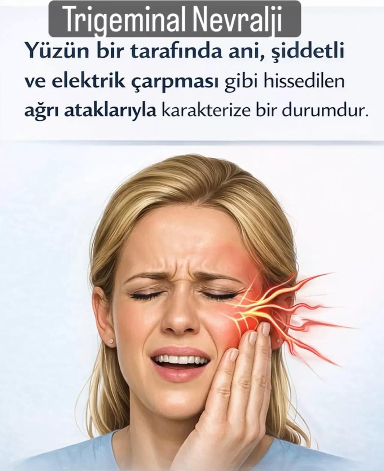 Trigeminal Nevralji: Yüzde Şiddetli Ağrı Ataklarına Yol Açan Rahatsızlık