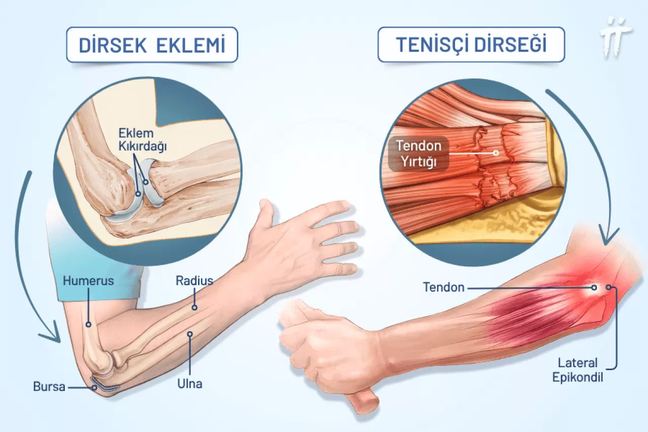 Dirsek Çıtırtıları Sessiz Bir Stresin Habercisi Olabilir