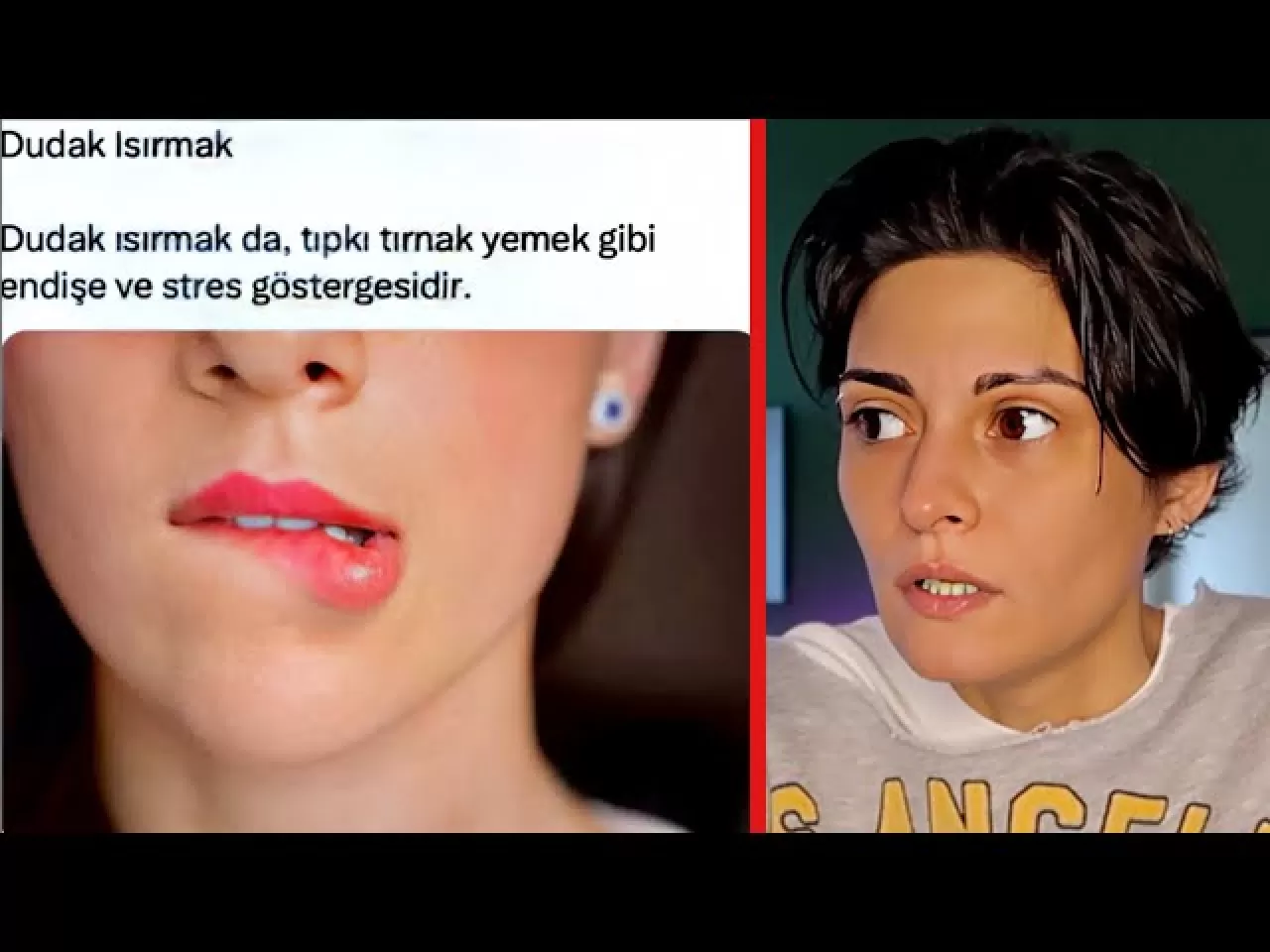 Stresin Sessiz İşareti: Kronik Dudak Isırma Alışkanlığı ve Erken Farkındalığın Önemi