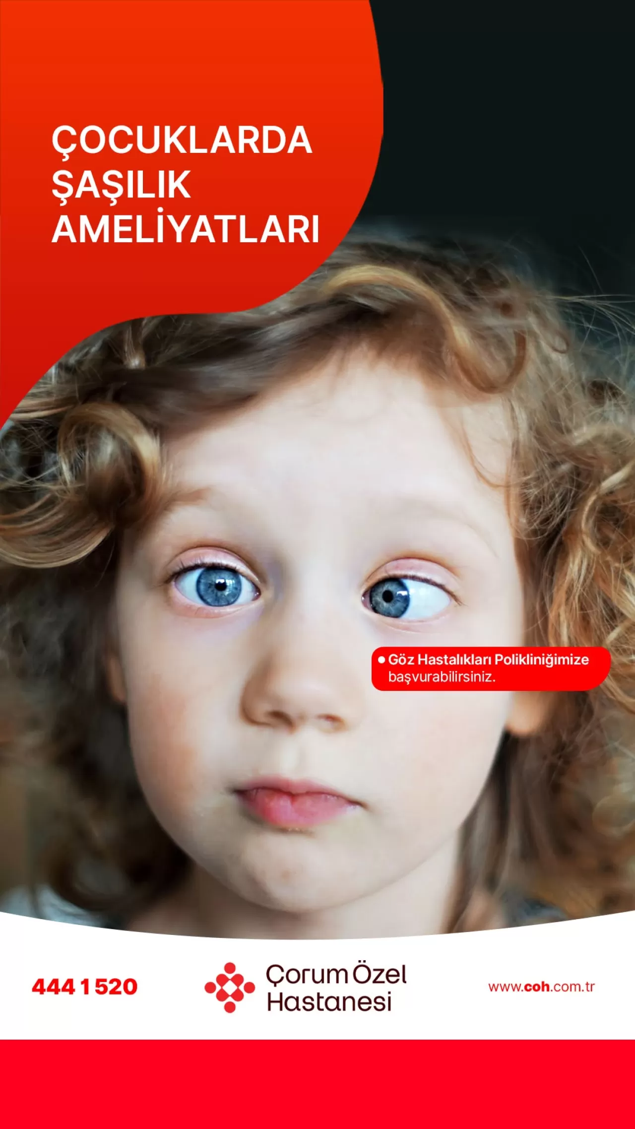 Çorum'da Çocuklarda Şaşılık Ameliyatları ile Kalıcı Görüş Kaybı Önleniyor