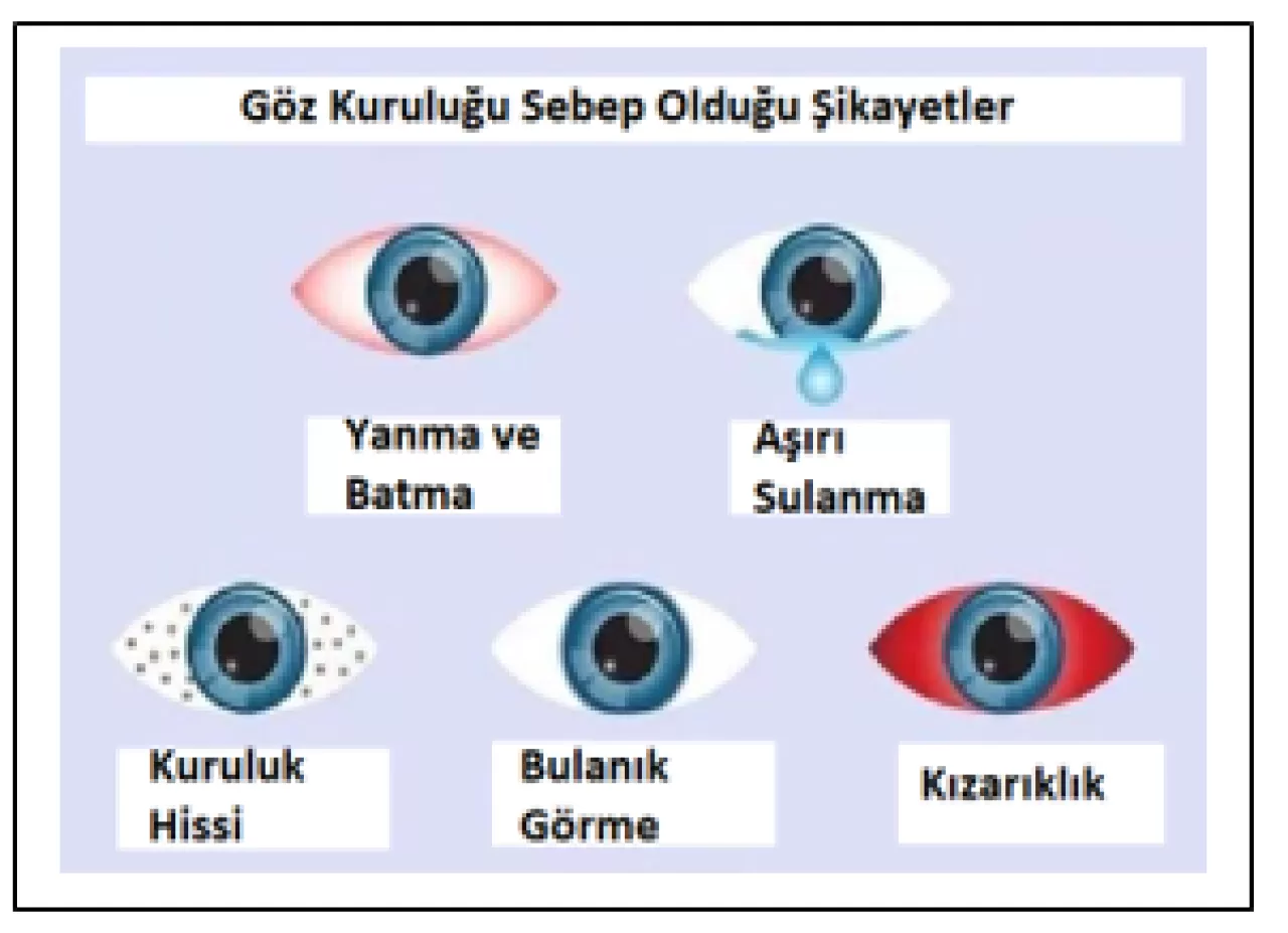 Sessiz Göz Kuruluğu: Kronik Göz Kırpma Ağrısının Sinsi Nedeni Olabilir