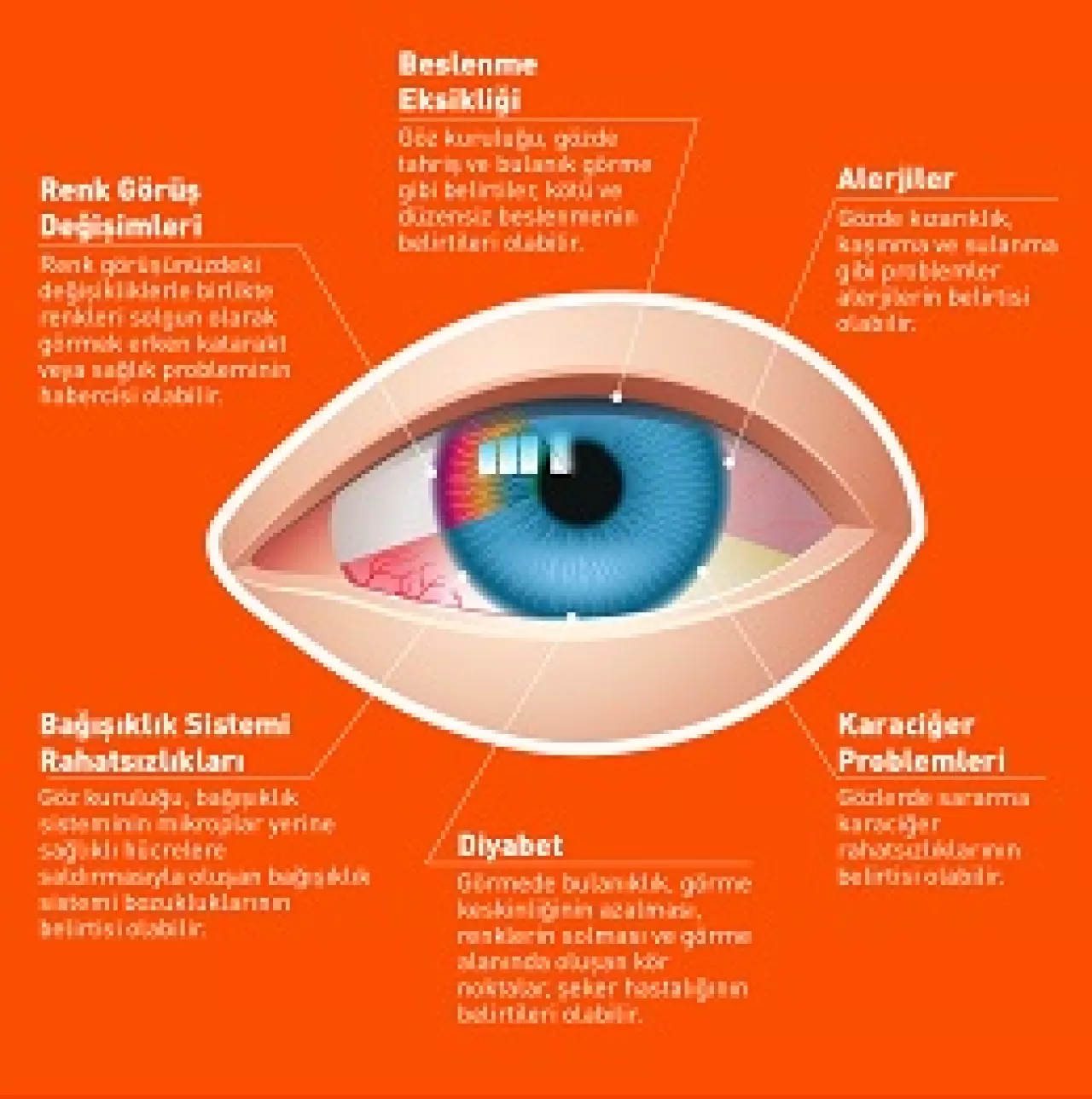 Gözleriniz Yorgun Mu? Dikkat! 