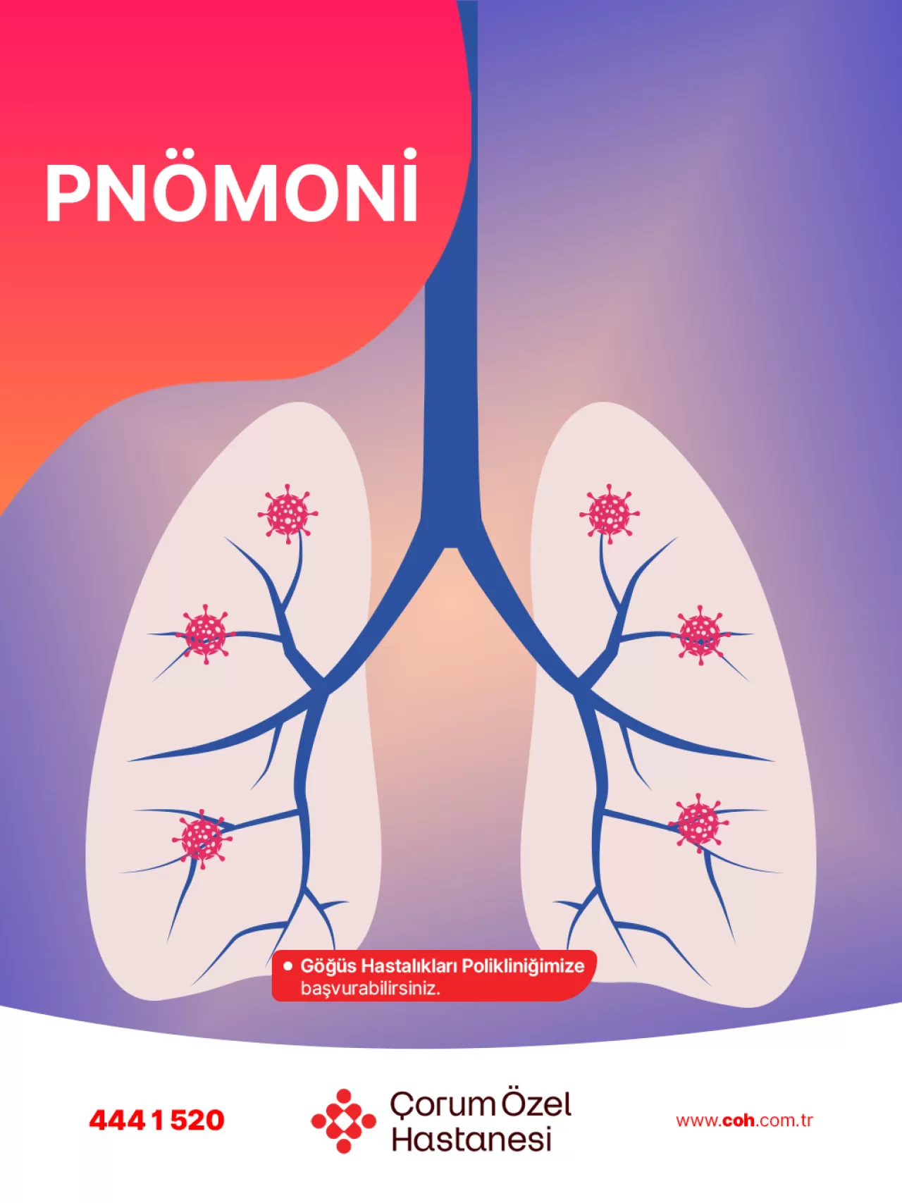 Çorum Özel Hastanesi'nde Zatürre (Pnömoni) Tanı ve Tedavisi