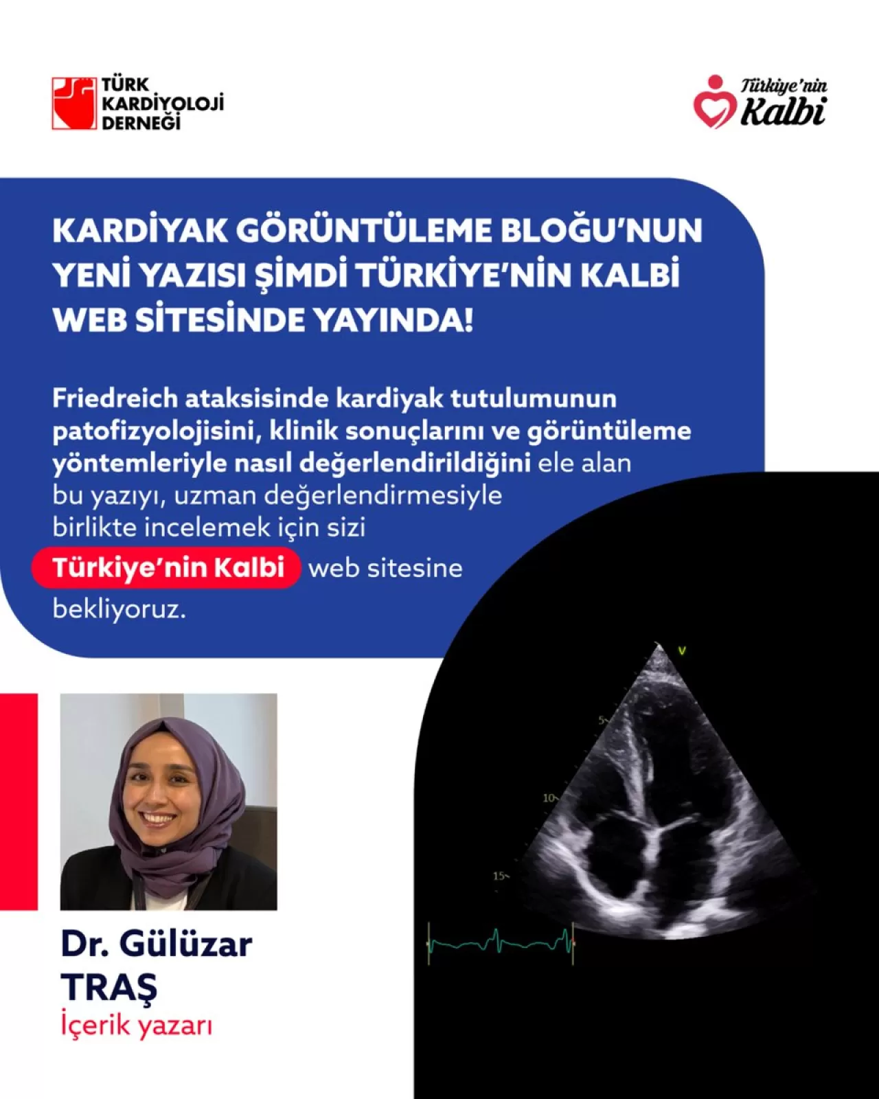 Friedreich Ataksisinde Kalp Tutulumu: Patofizyoloji, Klinik Sonuçlar ve Görüntüleme Yöntemleri