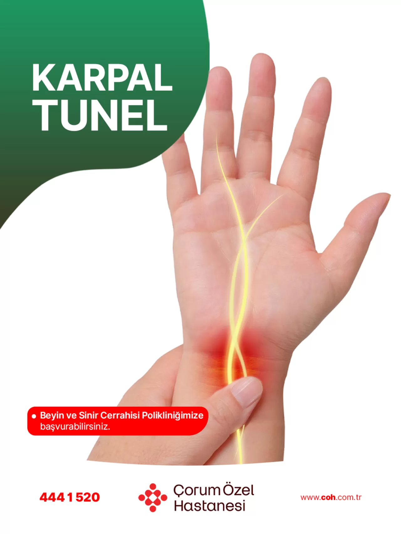 Çorum Özel Hastanesi'nden Karpal Tünel Sendromu Uyarısı: Belirtileri ve Tedavisi