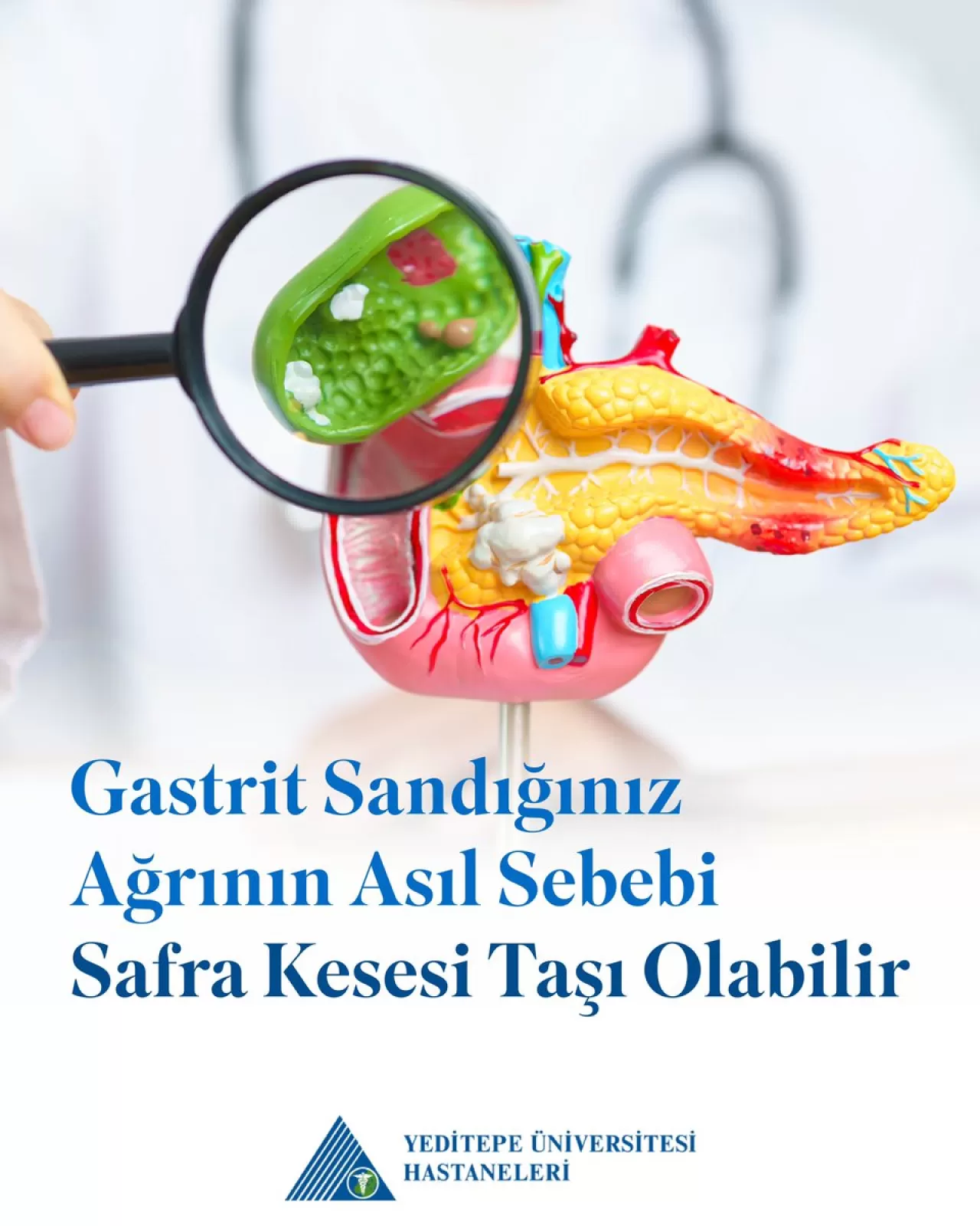 Safra Kesesi Taşı Belirtileri ve Tedavi Yöntemleri: Ani Karın Ağrısına Dikkat