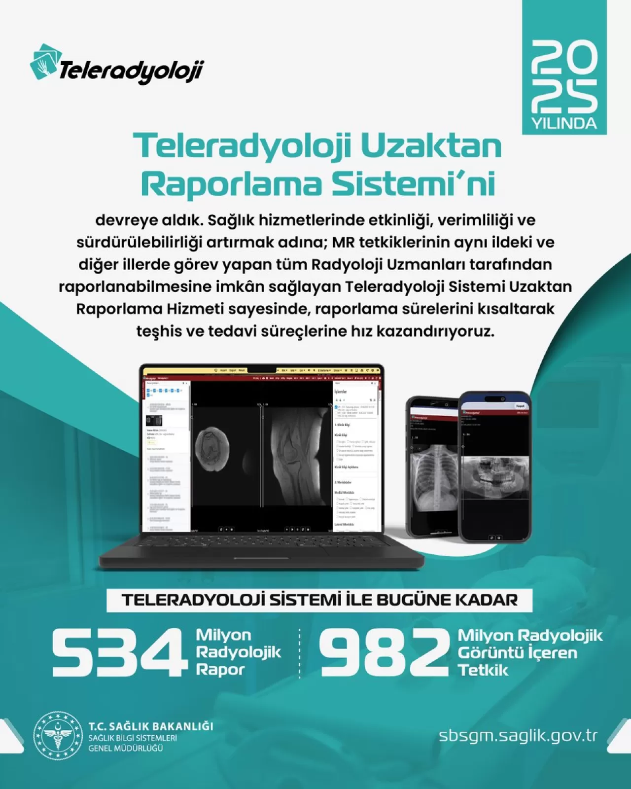 MR Raporlama Süreleri Teleradyoloji Sistemi ile Kısaldı