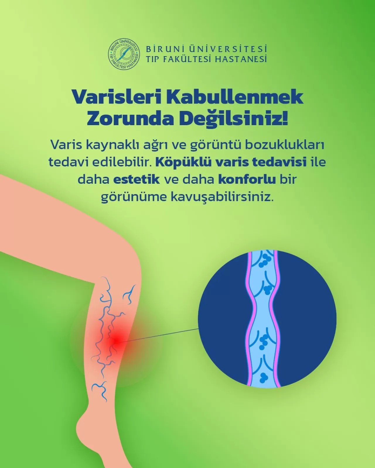 Biruni Üniversite Hastanesi'nde Köpüklü Varis Tedavisi ile Kesintisiz Yaşam