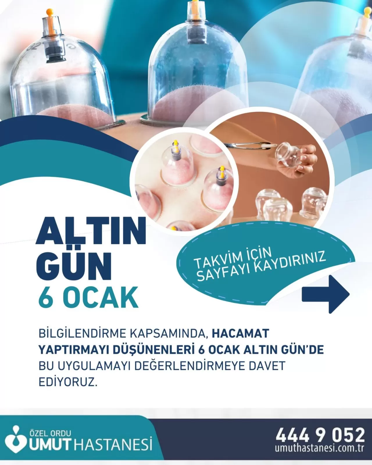 Özel Ordu Umut Hastanesi'nden 6 Ocak Altın Günü için Hacamat Önerisi