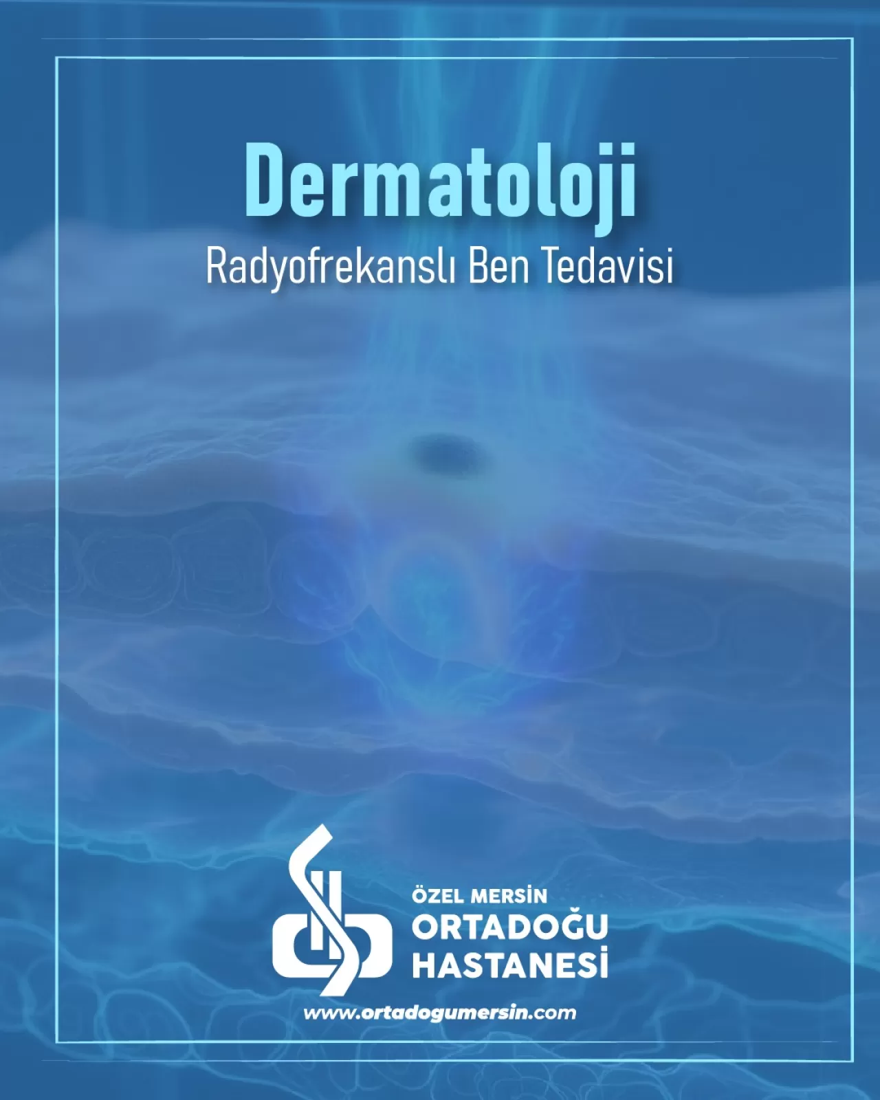 Mersin'de Lazerle Ben Tedavisi ile Güvenli Cilt Uygulaması