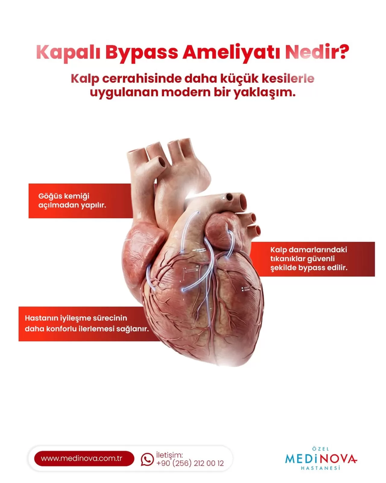 Medinova Hastanesi'nde Minimal İnvaziv Kalp Ameliyatı