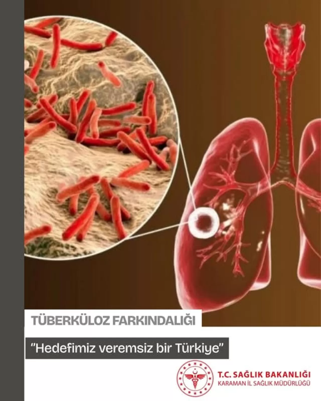 Karaman'da Verem Eğitimi ve Farkındalık Haftası Başladı