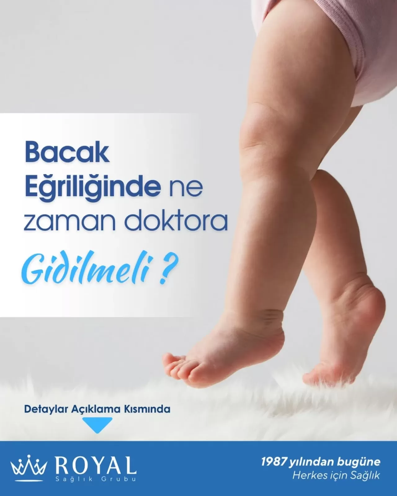 Bacak Eğriliği Belirtileri ve Tedavi Yöntemleri Hakkında Önemli Bilgiler