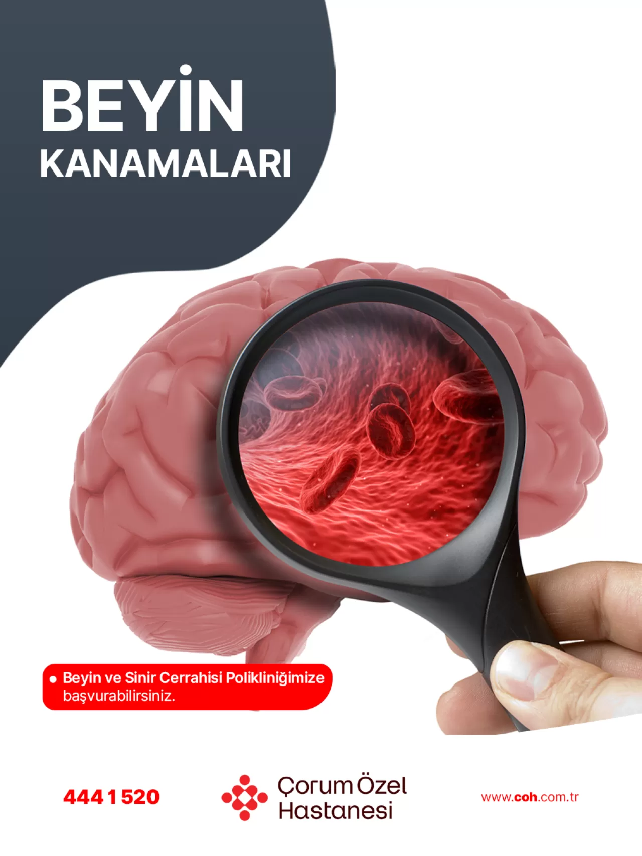 Çorum'da Beyin Kanamalarının Tanı ve Tedavisi İçin Uzman Desteği