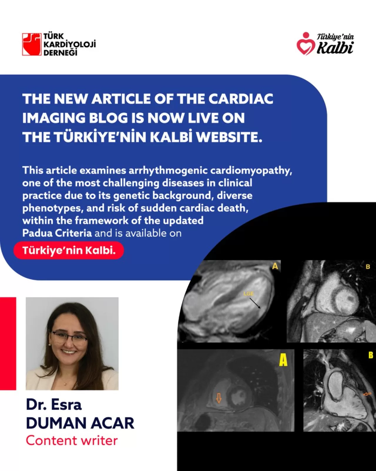 Türk Kardiyoloji Derneği'nin Güncel Kalp Görüntüleme Bloğu Yayında