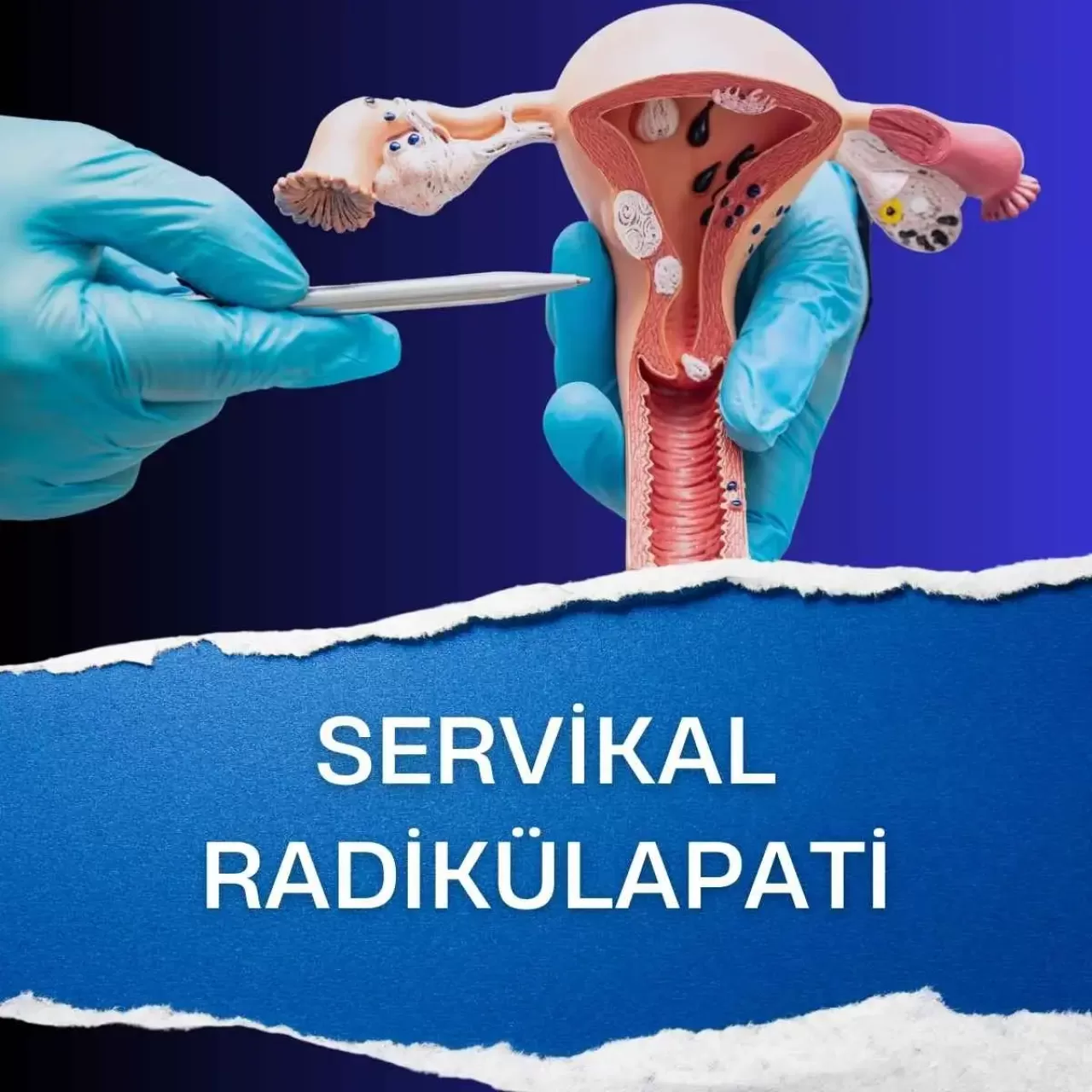 Boyun Ağrısı ile Gizlenen Tehlike: Sessiz Servikal Radikülopatiye Dikkat