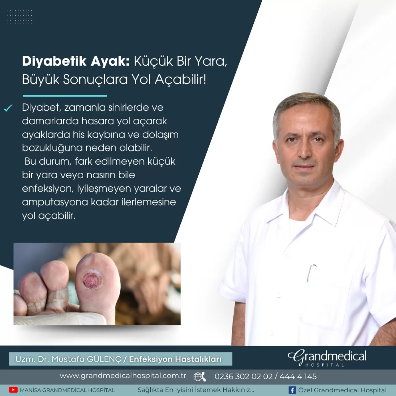 Diyabetik Ayak Yaralarına Dikkat: Erken Tanı Hayat Kurtarır