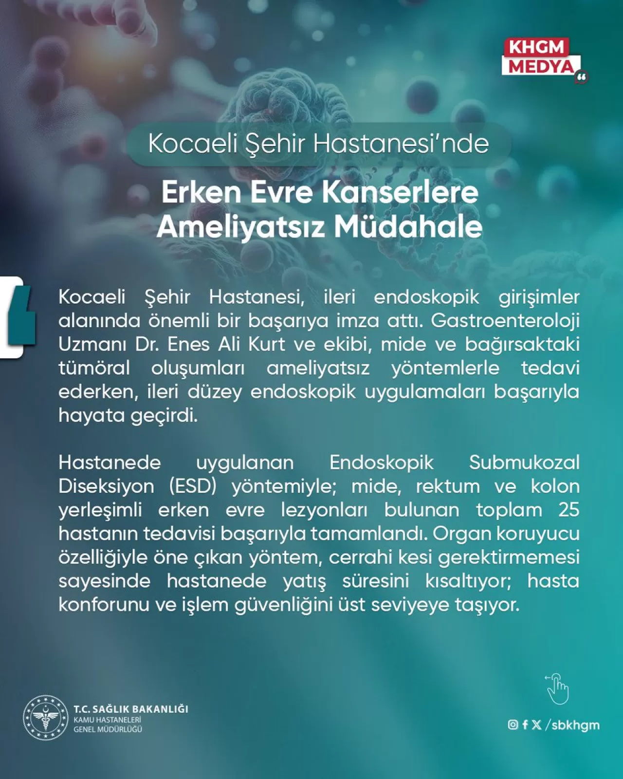 Kocaeli Şehir Hastanesi'nde Erken Evre Kanserler Ameliyatsız Tedavi Edilebiliyor