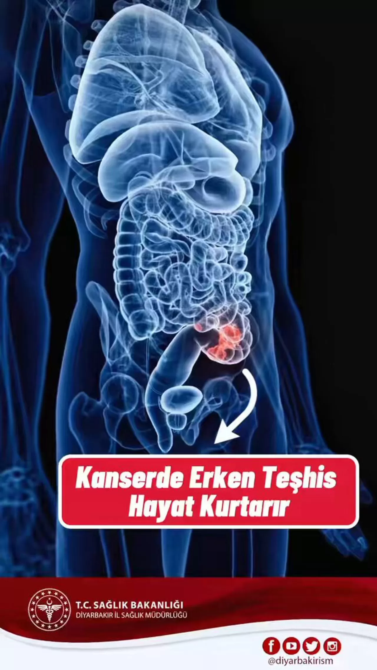 Diyarbakır Selahaddin Eyyubi Devlet Hastanesi'nde Kanser Farkındalık Etkinliği