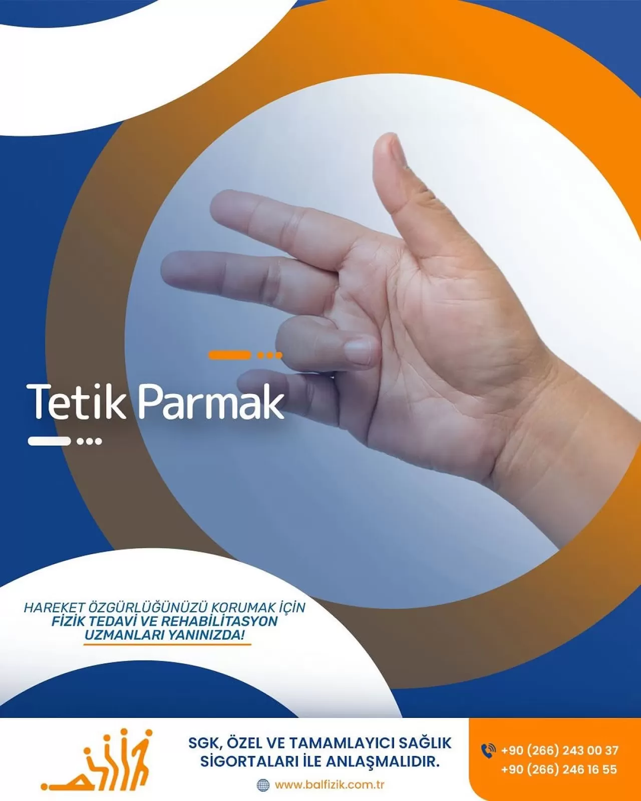 Tetik Parmak Rahatsızlığı: Belirtileri, Tedavi Yöntemleri ve Önemi