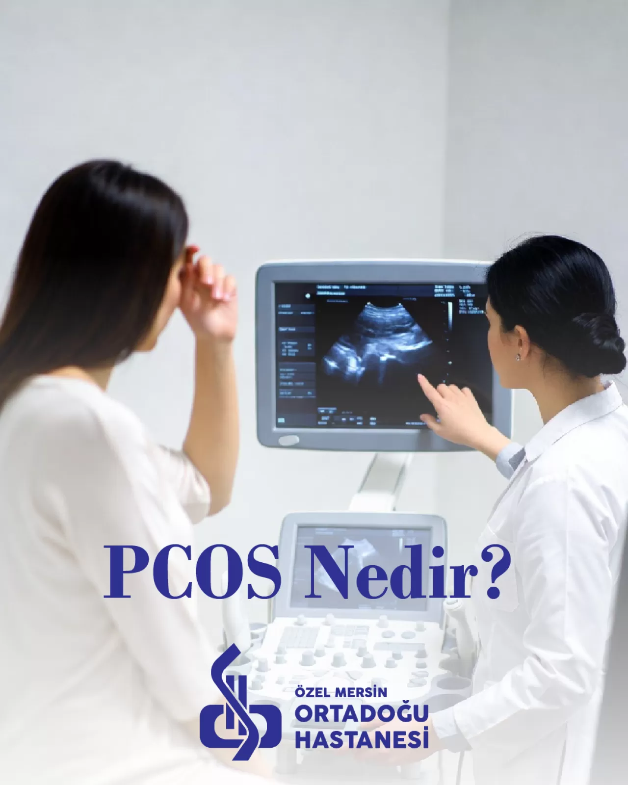 Polikistik Over Sendromu (PCOS) Nedir? Belirtileri ve Tedavi Yöntemleri
