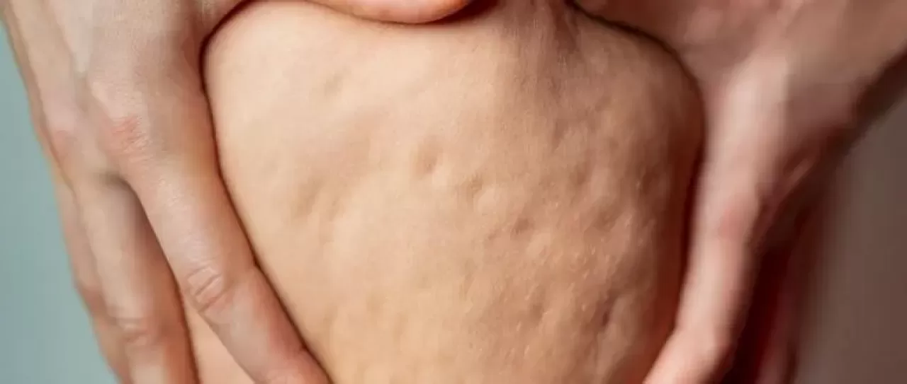 Gün İçindeki Yüz Şişliği Sessiz Bir Alarm Olabilir