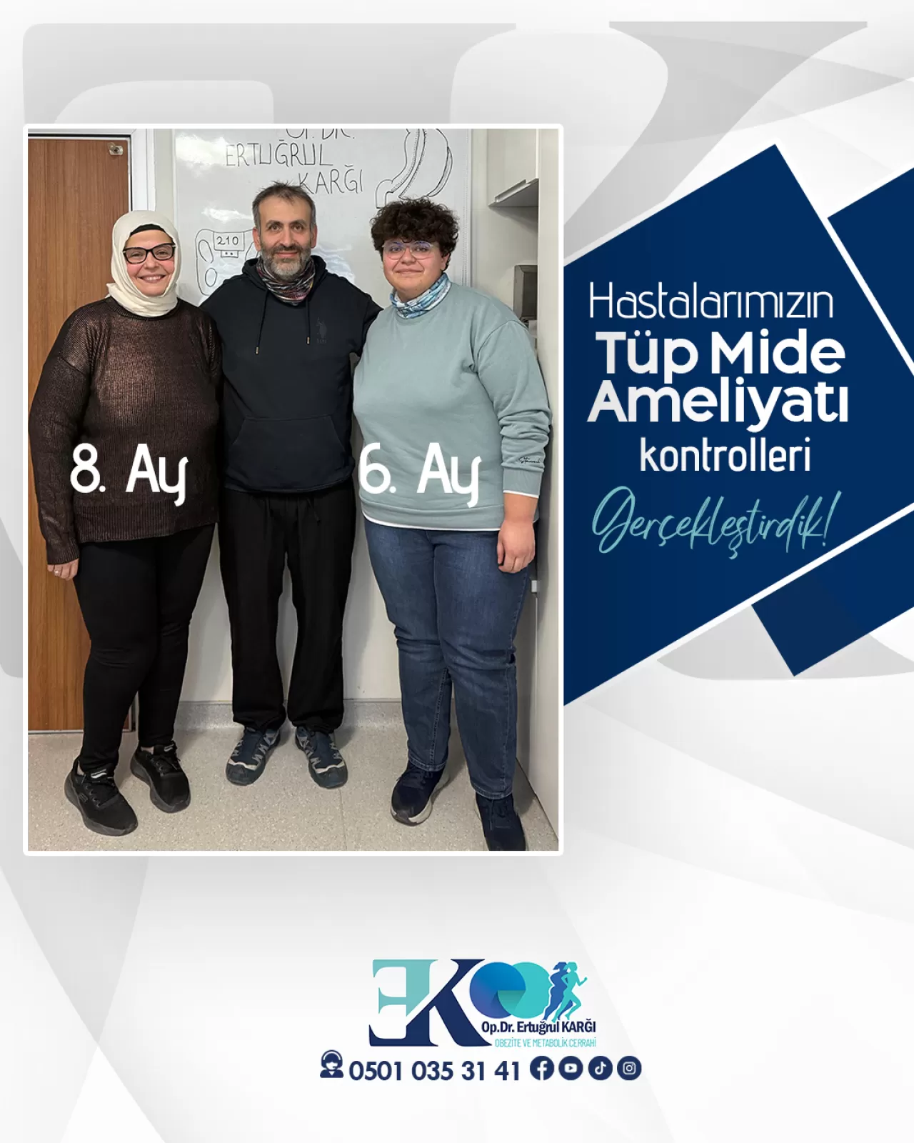 Tüp Mide Ameliyatı Hakkında Bilinmesi Gerekenler ve Sonuçları
