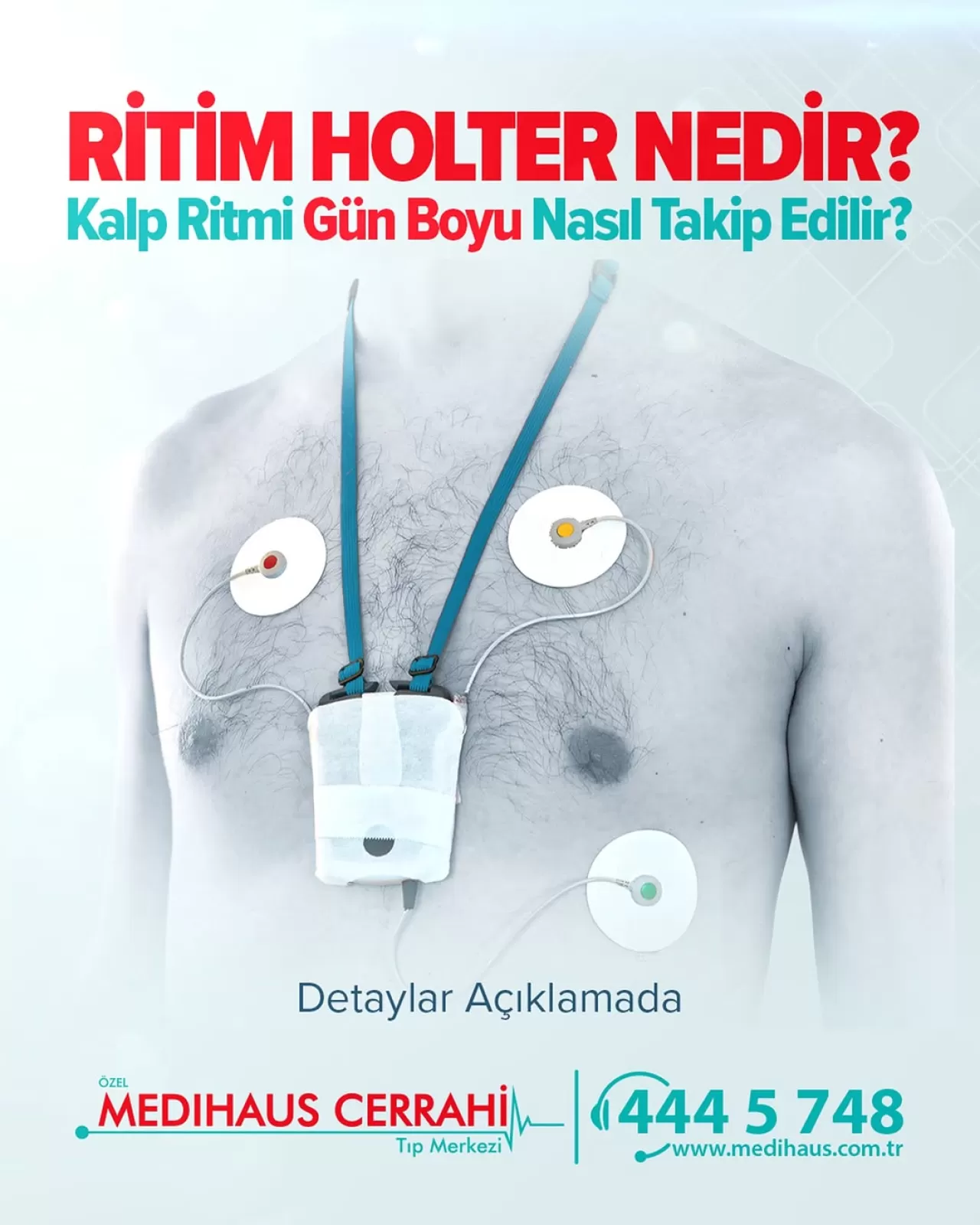 Ritim Holter ile Kalp Sağlığı 24 Saat Gözetim Altında