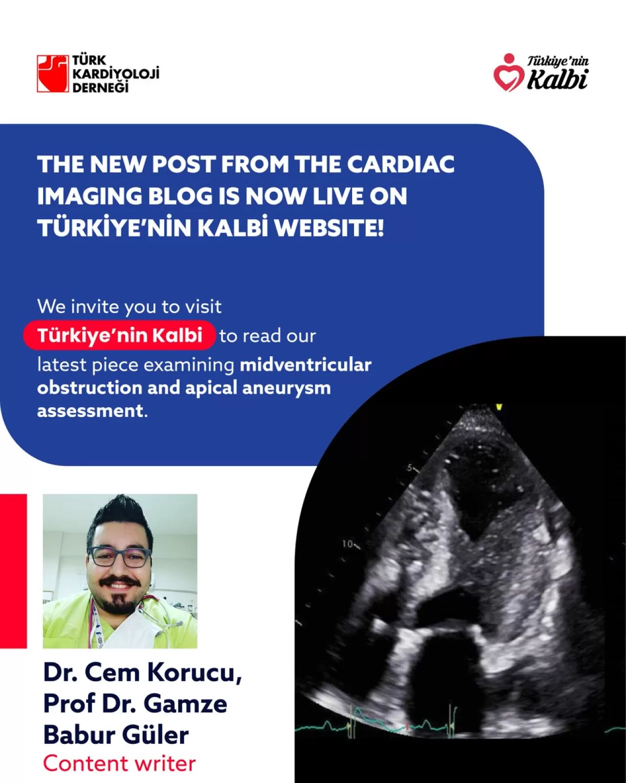 Türk Kardiyoloji Derneği, Midventriküler Obstrüksiyon ve Apikal Anevrizma Değerlendirmesini Paylaştı