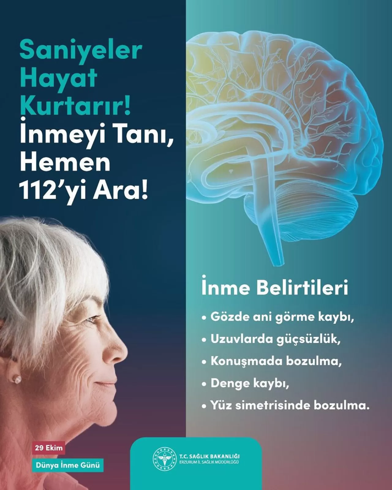 Erzurum İl Sağlık Müdürlüğü'nden 29 Ekim Dünya İnme Farkındalık Günü Açıklaması
